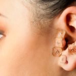 Auriculotherapy on female ear.